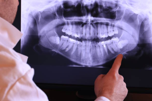 Best Dentist for Tooth Abscess  in Hartley, CA